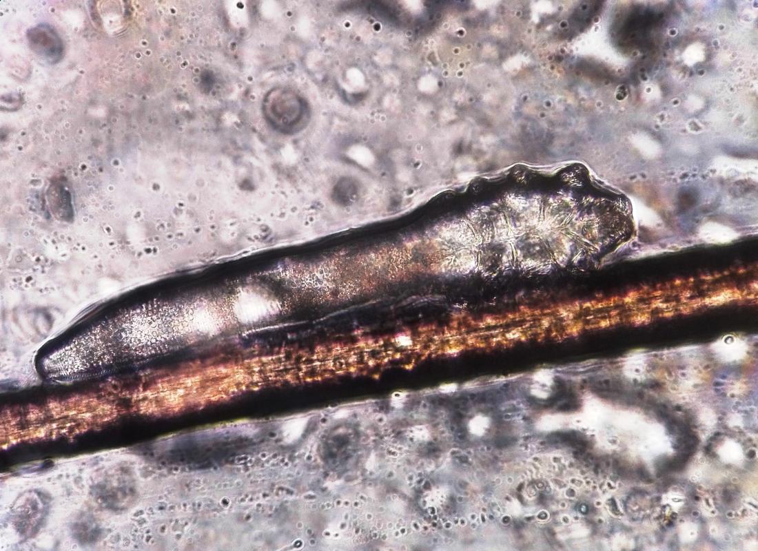 demodex optyk okulista